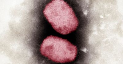 New monkeypox symptoms listed as vaccine rolled out in Scotland