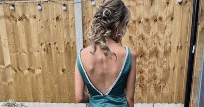 Teen with scoliosis wears backless dress at prom to proudly show her scar