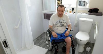Paisley man unable to have bath or shower for over a year after losing his leg