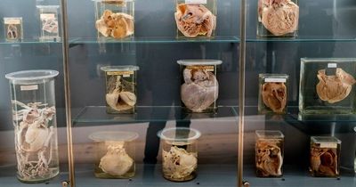 Over 50,000 deformed body parts from 18th century displayed in harrowing Vienna museum