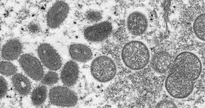 World Health Organisation declares Monkeypox a global emergency