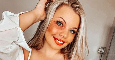 Woman called 'ugly' by strangers because of birthmark has last laugh by becoming a model