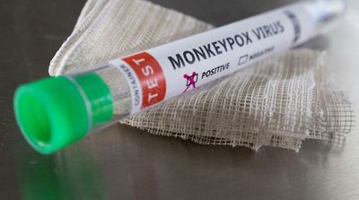UAE Announces 3 New Monkeypox Cases