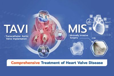 Vejthani Hospital announces comprehensive integrated aortic valve disease solutions