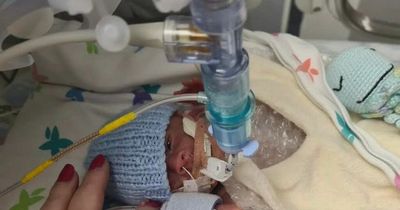 Lanarkshire dad working 70-hour weeks to pay mortgage as baby son fights for his life