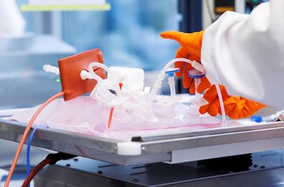 Bavarian Nordic in talks to expand monkeypox vaccine output