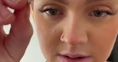 Woman claims Primark earrings made a chunk of her ear fall off in viral clip
