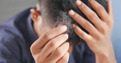 Scientists find cure for baldness - and it could also help wounds heal faster