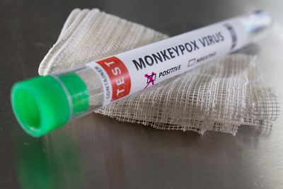 British agencies secure funds to develop standard monkeypox tools