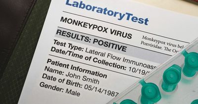 Monkeypox infections on the rise as Brits warned to check for rashes and blisters