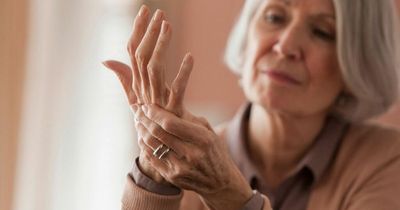 Do your hands look like this? Warning symptom of liver disease includes red palms
