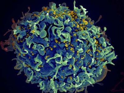 US man, 66, becomes fourth patient seemingly cured of HIV