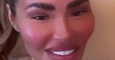 Chloe Sims shows off dramatic makeover after painful injections and threads in face