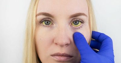 Is hepatitis contagious? Signs and symptoms you should never ignore