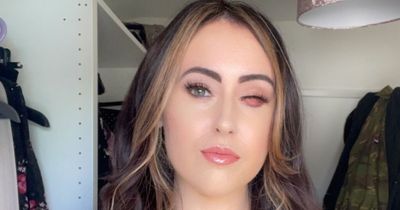 Barmaid bullied for missing eye by nasty drinkers gets incredible replacement