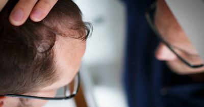 Hair loss most likely to happen in September due to 'seasonal shedding', warns expert