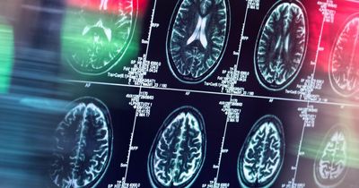 Eating cookies and crisps ‘linked to increased risk of dementia'