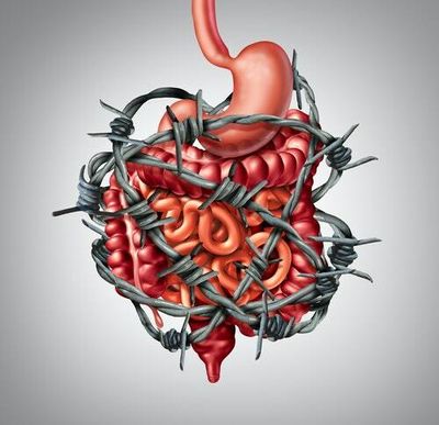 This common immune response might be behind IBS pain — a new study finds