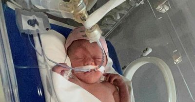 Couple whose baby was born prematurely say insurers won't cover the costs to bring him home