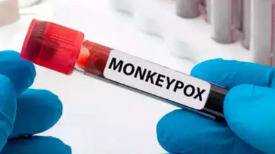 2 more monkeypox suspects in Maharashtra test negative