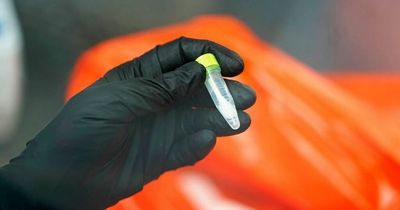 Spain records first monkeypox related death
