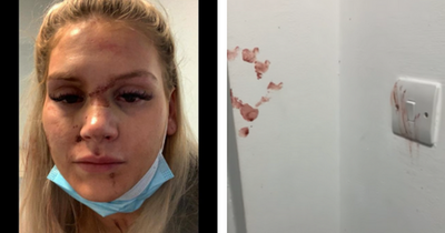 Woman's horror injuries and blood-spattered walls after ex brutally attacked her