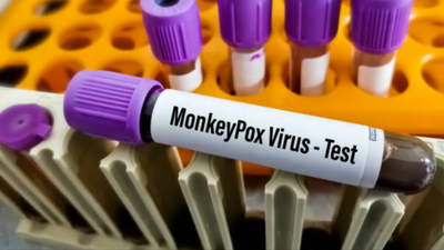 Noida: All 4 suspected patients test negative for monkeypox