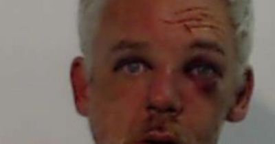 Edinburgh man missing for hours as police launch urgent appeal to trace him