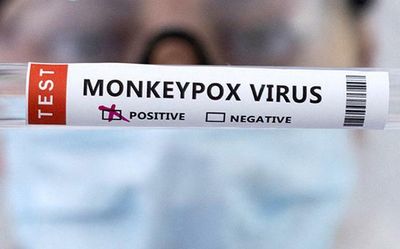 Ethiopian national with monkeypox symptoms quarantined in Karnataka; test reports awaited