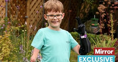 Schoolboy's brave fightback with biopic arm after losing limbs to meningitis