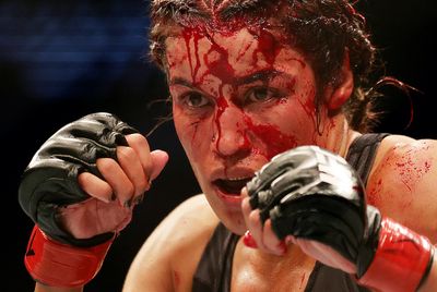 Dana White: Julianna Peña lost ‘big chunk’ of forehead at UFC 277, needs surgery