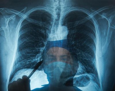 NHS campaign urges people not to ignore lung cancer symptoms