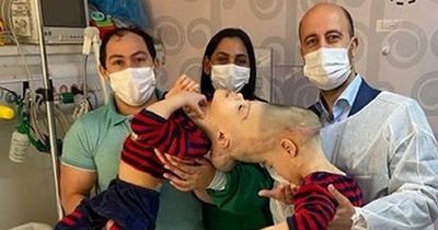 Conjoined twins successfully separated after 27 hours of 'space age' surgery