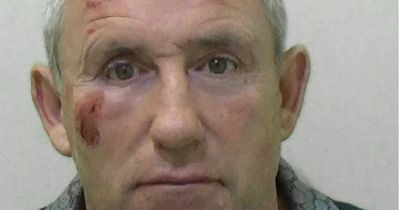 Drunken fisherman left officer's finger permanently deformed in attempted headbutt attack