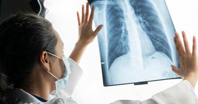 Hidden lung cancer symptoms warning as NHS launch new awareness campaign