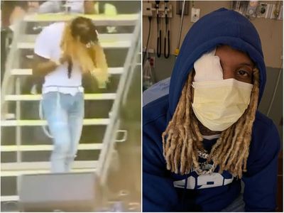 Lil Durk taking break to ‘focus on his health’ after Lollapalooza injury