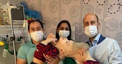 Neurosurgeon separates conjoined twins born with brains 'fussed' together after 27-hour surgery