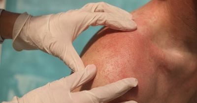 Psoriasis symptoms and signs your scaly skin patches could be immune disease