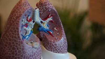 Lung Foundation says federal government must implement cancer screening to save 12,000 lives