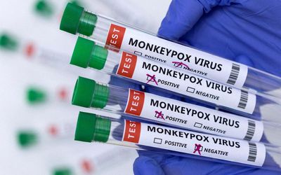 Monkeypox: Fifth case of virus reported from Kerala