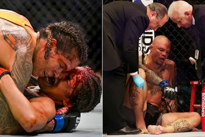UFC 277 medical suspensions: Amanda Nunes, Julianna Peña out indefinitely; Anthony Smith gets 30 days after breaking ankle