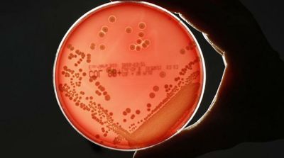 Scientists Spot ‘Selfish’ Behaviors in Bacteria World