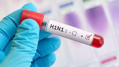July H1N1 cases rise five-fold in Mumbai this year; leptospirosis, dengue too see surge