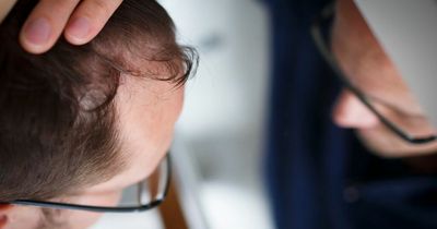 Hair loss most likely to happen in September due to 'seasonal shedding', expert warns