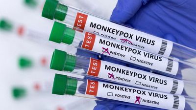 More than 2000 cases of monkeypox confirmed in France, no fatalities
