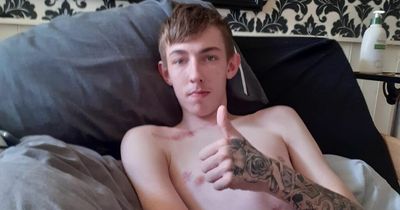 Teen hailed as "fighter" after return home following horror motorbike accident