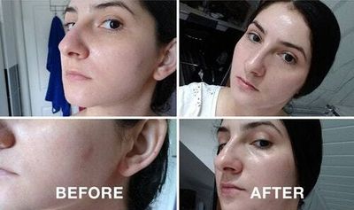 I tried Facetheory's new toner exfoliator on my sensitive skin, and it really works