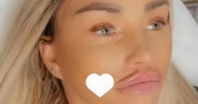 Katie Price shows off her huge new pout after getting even more lip filler