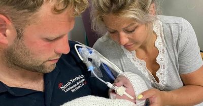 Short life of tiny baby Ronnie taught parents how to 'love harder than we ever knew'