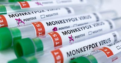 Monkeypox cases jump in a week with 97 cases now in Ireland